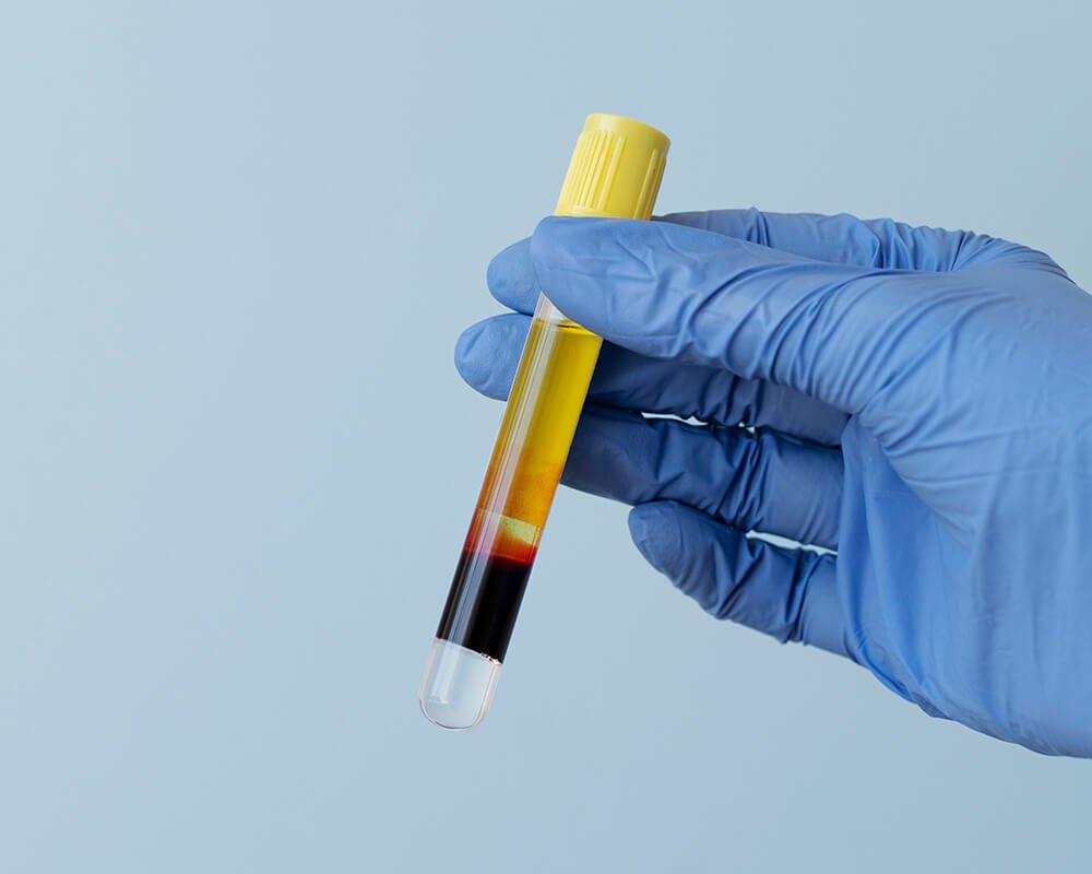 PRP Therapy for Pain Relief | Restore Joint Care in Suwanee, GA